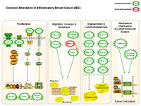 Inflammatory breast cancer PPT Slide
