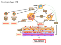 Molecular pathology of COPD PPT Slide